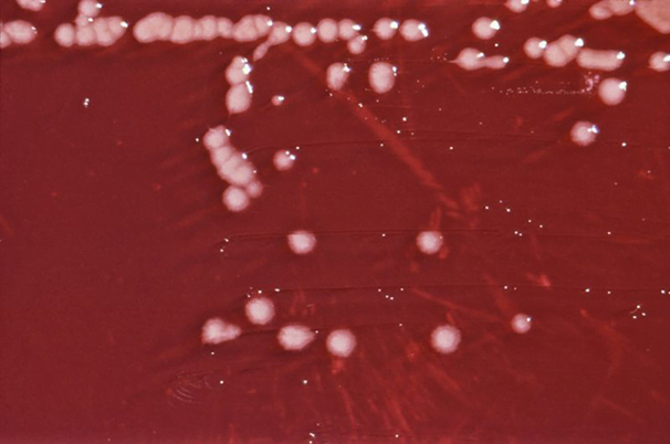 Pseudomonas aeruginosa bakteeri